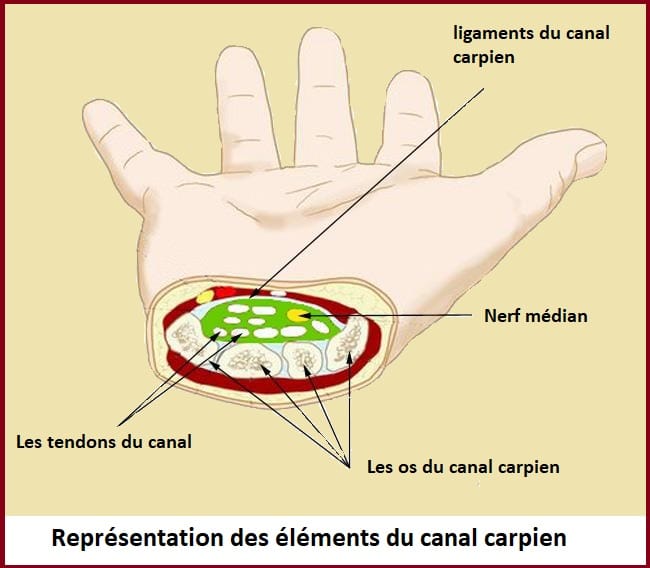 Syndrome du canal carpien- représentation du canal