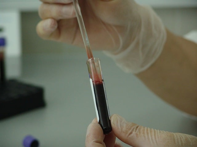 cancer du sang: tube plein de sang
